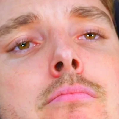 LazarBeam
